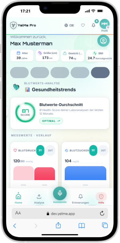 Trends Verlauf